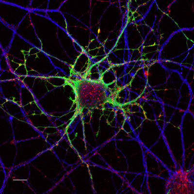 Neuron picture in color